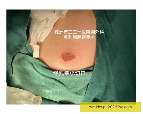 坎宁安气胸康复持续推进 活塞计划一周后复查评估 坎宁安气胸康复持续推进 活塞计划一周后复查评估